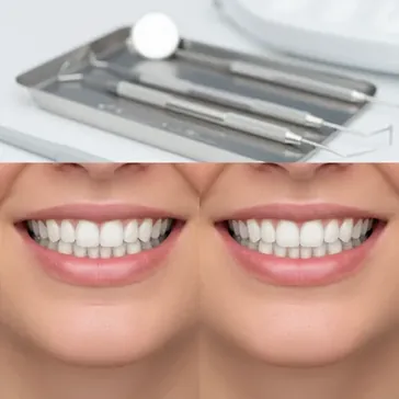 Przerwy midzy zbami: Kompleksowy przewodnik o diastemie przed i po